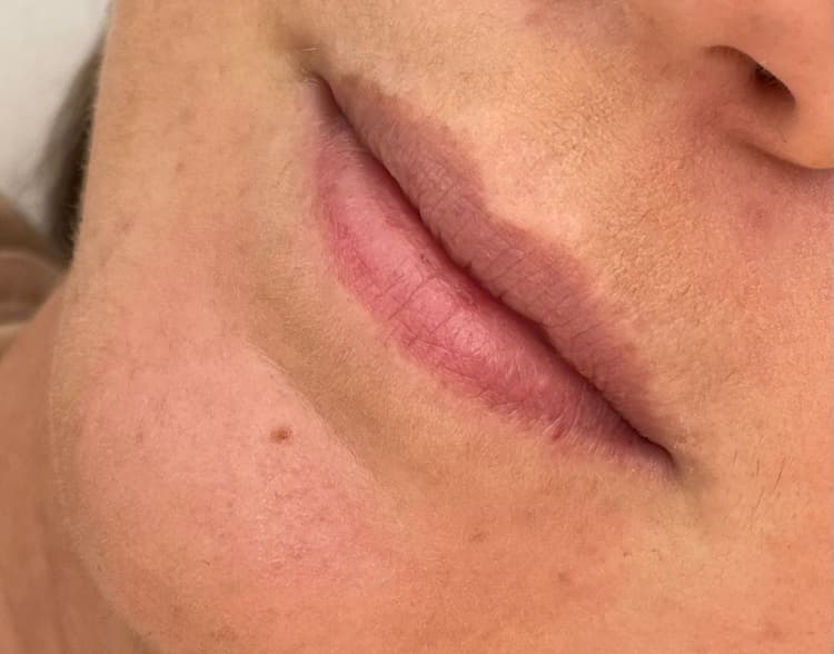 Dermopigmentazione labbra - es. 21