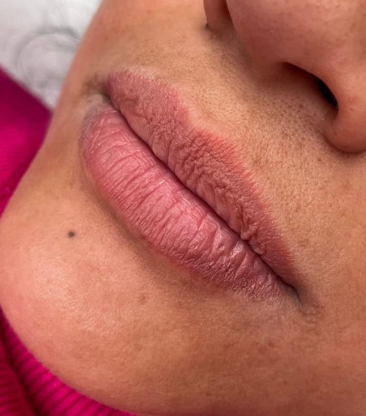 Dermopigmentazione labbra prima