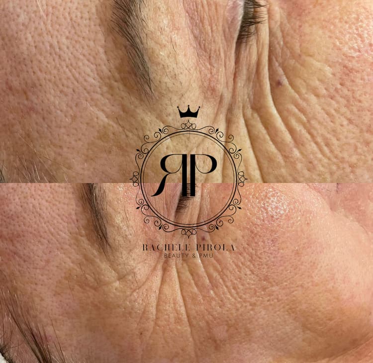 Fili tensori cosmetici - es. 01