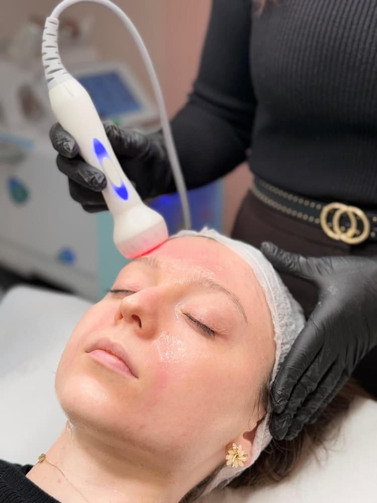 Radiofrequenza - es. 01